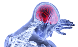 ネットワークから捉える半側空間無視の病態