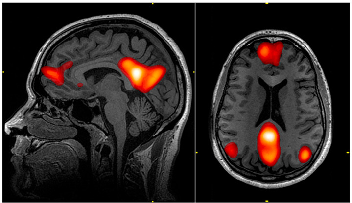 社会認知神経科学：その中核的プロセス　2