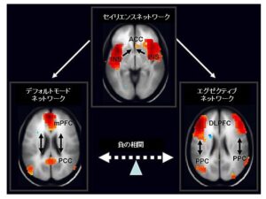 デフォルトモードネットワークと心の障害