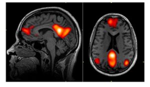 こころはどこにあるのか？デフォルトモードネットワークの脳科学