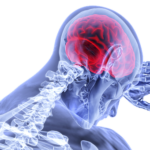 ネットワークから捉える半側空間無視の病態