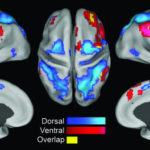 自発的な脳活動から覗く２つの注意機能
