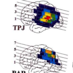 内的注意と外的注意:上頭頂小葉と下頭頂小葉の違いとは?