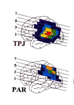 内的注意と外的注意:上頭頂小葉と下頭頂小葉の違いとは?