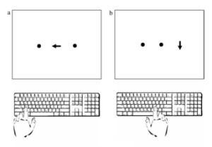 三種類の半側空間無視？半側空間無視のサブタイプ判別について