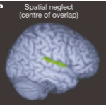 半側空間無視の本当の責任領域はどこなのか？