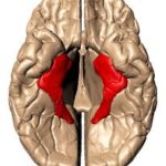 海馬傍回と角回、半側空間無視の関係について