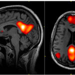 社会認知神経科学:その中核的プロセス 2