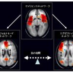 デフォルトモードネットワークと心の障害