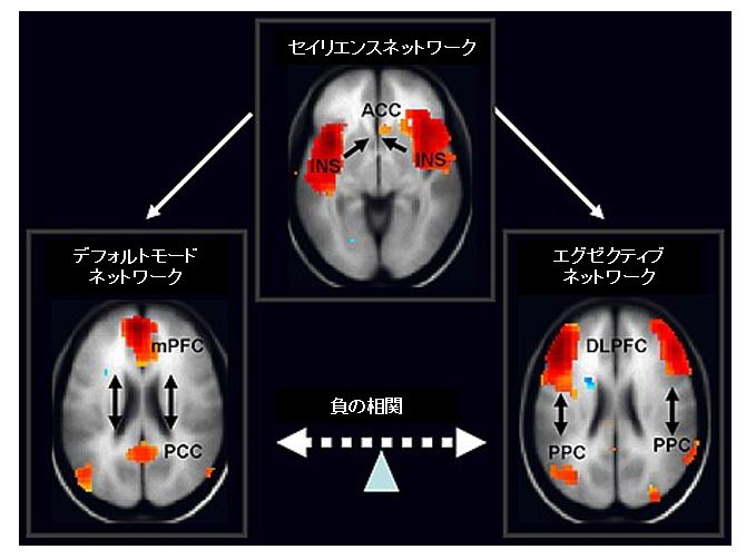 デフォルトモードネットワークと心の障害